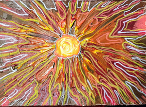 Sunburst